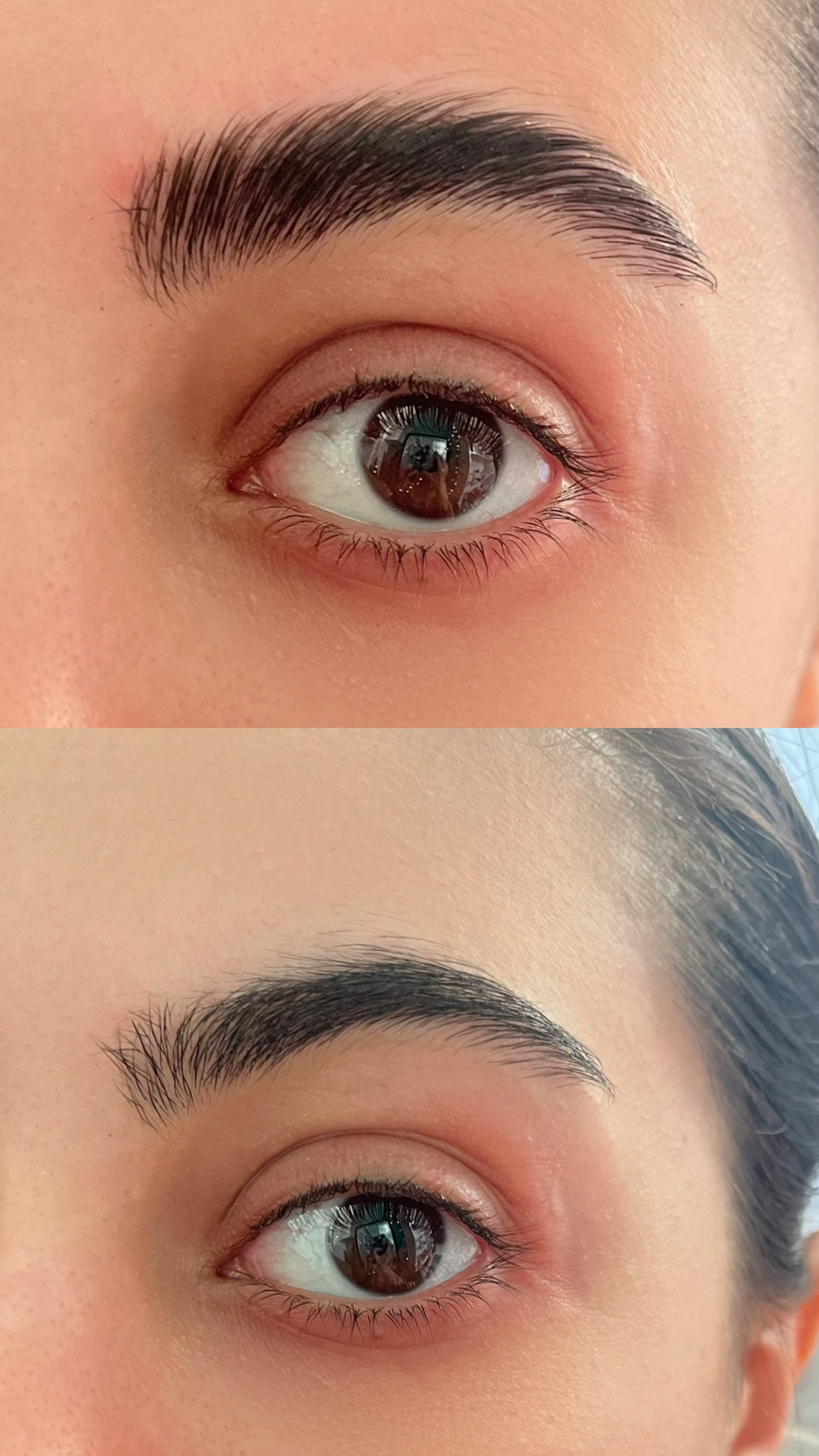 ژل لیفت معروف یاسشاپ